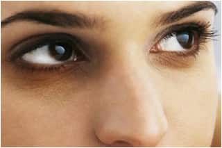 डार्क सर्कल्स को हमेशा के लिए कैसे हटाएं?