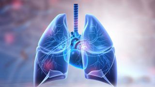 Lung Cancer Affects Non-smokers Too: Research | Details Inside