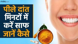 Health Tips: घरेलू उपाए जिससे आपके पीले दांत मिनटों में हो जायेंगे सफ़ेद | Watch Video