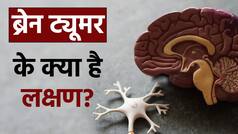 शरीर में ये वार्निंग साइन बताते हैं कि ब्रेन में ट्यूमर बनना शुरू हो गया है, जानिए किसको है ज़यादा रिस्क | Watch Video