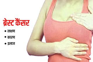 Breast Cancer: स्तन कैंसर क्या है, इसके लक्षण, कारण और इलाज के साथ ही जानिए जोखिम कारक
