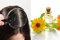 Dandruff Remedies: Does Oiling Hair Increase Dandruff? Expert Speaks!