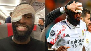 Antonio Rudiger Survives Big Scare in Real Madrid vs Shakhtar Donetsk Game, Receives 20 Stitches in Head