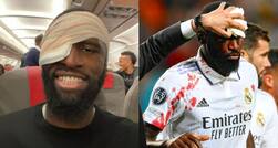 Antonio Rudiger Survives Big Scare! Receives 20 Stitches in Head