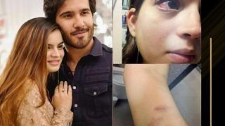 Pakistani Actor Feroze Khan's Ex-Wife Syeda Aliza Shares Photos of Bruised Body Parts After Alleging Physical Abuse