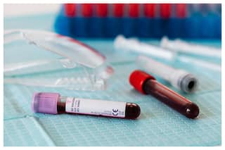 New Blood Group Identified That Poses Serious Threats To Babies In Pregnant Women