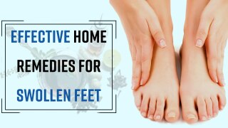 Health Tips: Easy And Effective Home Remedies For Swollen Feet | Watch Video