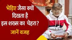 Lalit Patidar: लंबे-लंबे बालों से क्यों ढका है ललित पाटीदार का चेहरा? वीडियो में जानिए इसके पीछे का कारण |Watch Video