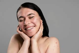Winter Glow Tips: 4 Must-Have Skin Care Ingredients For Your Beauty Regime