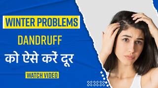 Home Remedies For Dandruff: इन घरेलू उपायों से डैंड्रफ को करें गायब | Watch Video