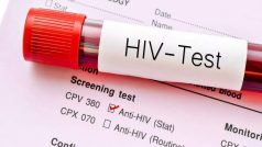 HIV क्या है? इंसानों में कैसे फैला, इसके लक्षण और चरणों के बारे में भी जानें