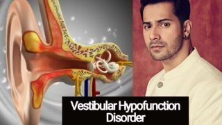 Varun Dhawan Health Update: Actor Says Yoga Helps Him With Vestibular Hypofunction - Know All About The Disease Here