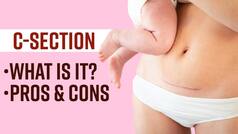 Alia Bhatt Opts For C-Section Delivery, What Is It? Why It's Done And What Are The Pros And Cons Of C-Section - Watch Video