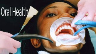 Oral Health: दुनिया की आधी आबादी को मुंह से जुड़ी बीमारी, हर साल करीब 4 लाख और जुड़ रहे