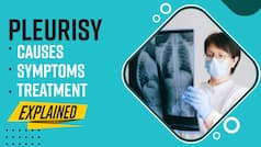 HEALTH: Chest Pain While Coughing Or Sneezing Can Be A Sign Of Pleurisy Disease, Know The Causes And Prevention | Watch Video