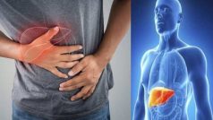 फैटी लिवर के कारण: ये 5 आदतें हो सकती हैं फैटी लिवर के लिए जिम्मेदार