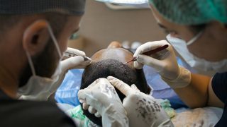 Delhi Man Dies After Hair Transplant Goes Horribly Wrong