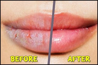 ग्लिसरीन में मिलाकर लगाएं ये चीजें, सर्दियों में होंठ दिखेंगे खिले-खिले