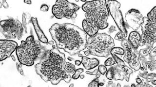 निपाह वायरस संक्रमण की जांच के लिए ICMR ने बनाया ELISA टेस्ट, चुटकियों में चलेगा पता