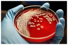 Latest Antibiotics Not Working On Bacterial Infection Raising Fear Of High Mortality Rate: WHO Report