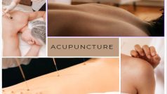 Acupuncture: जानें एक्यूपंक्चर क्या है और कैसे हमें स्वास्थ्य लाभ देता है?