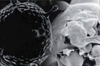 यूपी में मिला ब्लैक-व्हाइट फंगस का पहला मरीज, गाजियाबाद में भर्ती; स्वास्थ्य विभाग ने की पुष्टि