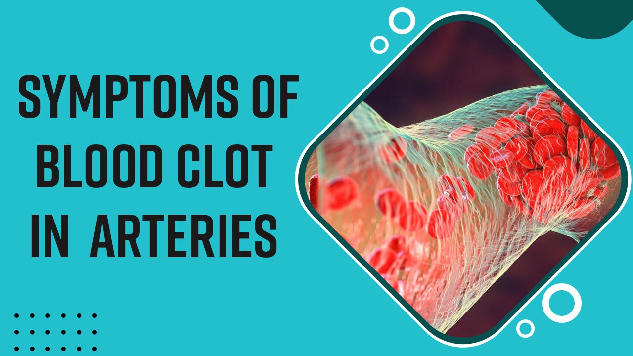Heart Health Tips: Signs That You Have A Blood Clot In Your Arteries And Can Be Serious | Watch Video