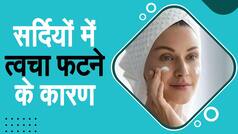 Health Tips: सर्दियों में रूखी त्वचा से हैं परेशान तो वीडियो में जानें कारण और इलाज | Watch Video