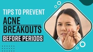 Health Tips: Effective Tips To Prevent Acne Breakouts Before Periods - Watch Video