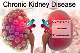 Chronic Kidney Disease: किडनी की बीमारी क्या है, इसके लक्षण, कारण और इलाज भी जानें