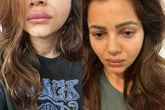 Rubina Dilaik Shares Pics of Her Swollen Face And Duck Lips, Fans Say 'We are Worried For You'