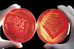 11-year Old Boy Dies After Flesh-Eating Bacteria Develops In Twisted Ankle; Know What Is It And How It Spreads