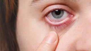 Glaucoma: Warning Signs, Symptoms, Causes And Treatment