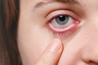 Glaucoma: Warning Signs, Symptoms, Causes And Treatment