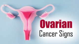 Ovarian Cancer: 6 Warning Signs To Look Out For In Young Females