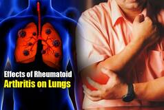 Rheumatoid Arthritis Affects Lungs: Check Symptoms, Treatment And Prevention