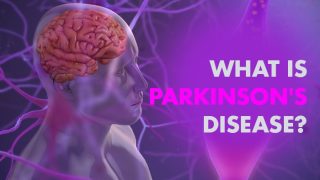 Parkinson's Disease is a Serious Brain Disorder: Is There Any Cure? All FAQ'S Answered by Expert