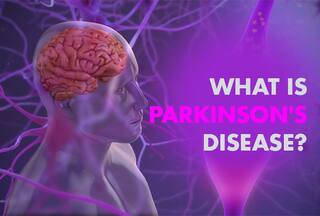 Parkinson's Disease is a Serious Brain Disorder: Is There Any Cure? All FAQ'S Answered by Expert