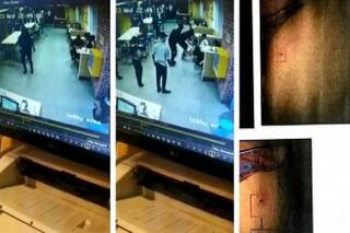 Viral: लोकप्रिय फास्ट फूड कंपनी के आउटलेट में चूहे ने बच्चे को काट लिया, पिता ने दर्ज कराई शिकायत