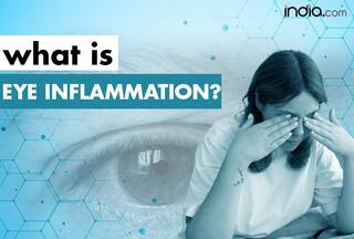 Eye Inflammation: Symptoms, Causes And Treatment of Uveitis