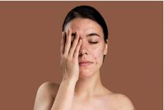Psoriasis: Symptoms to Lifestyle Changes, All You Need to Know About This Autoimmune Skin Condition