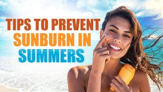 Summer Care: Tips To Prevent Sunburn During Summers - Watch Video