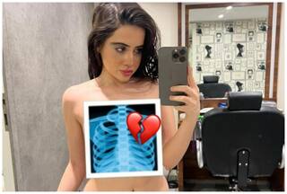 Urfi Javed Sets The Internet Ablaze as She Shares Topless Pic Post X-Ray