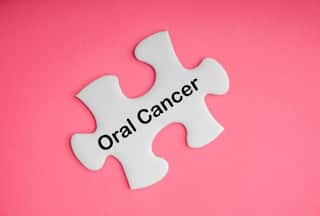 Oral Health: How to Identify Early Signs And Symptoms of Oral Cancer?