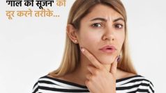 गाल की सूजन से हैं परेशान? तो कम करने के लिए अपना सकते हैं ये तरीके