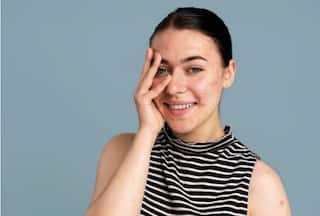 Psoriasis Skincare: 5 Ways to Manage This Skin Condition in Summer