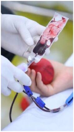 ब्लड डोनेशन से शरीर को पहुंचता है नुकसान? यहां जानें पूरी बात