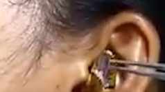 सोती हुई लड़की के कान में घुस गया खतरनाक सांप
