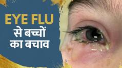 Eye Flu Treatment: सावधान! बच्चों में तेजी से फैल रहा Eye Flu, जानें कैसे करें बचाव | Watch Video