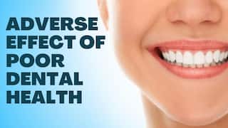 Oral Care Tips: Here's How Poor Dental Health Can Affect Your Overall Well-Being | Watch Video